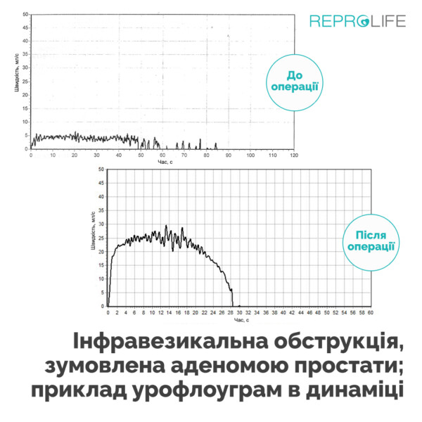 Какие возможности урофлоуметрии?