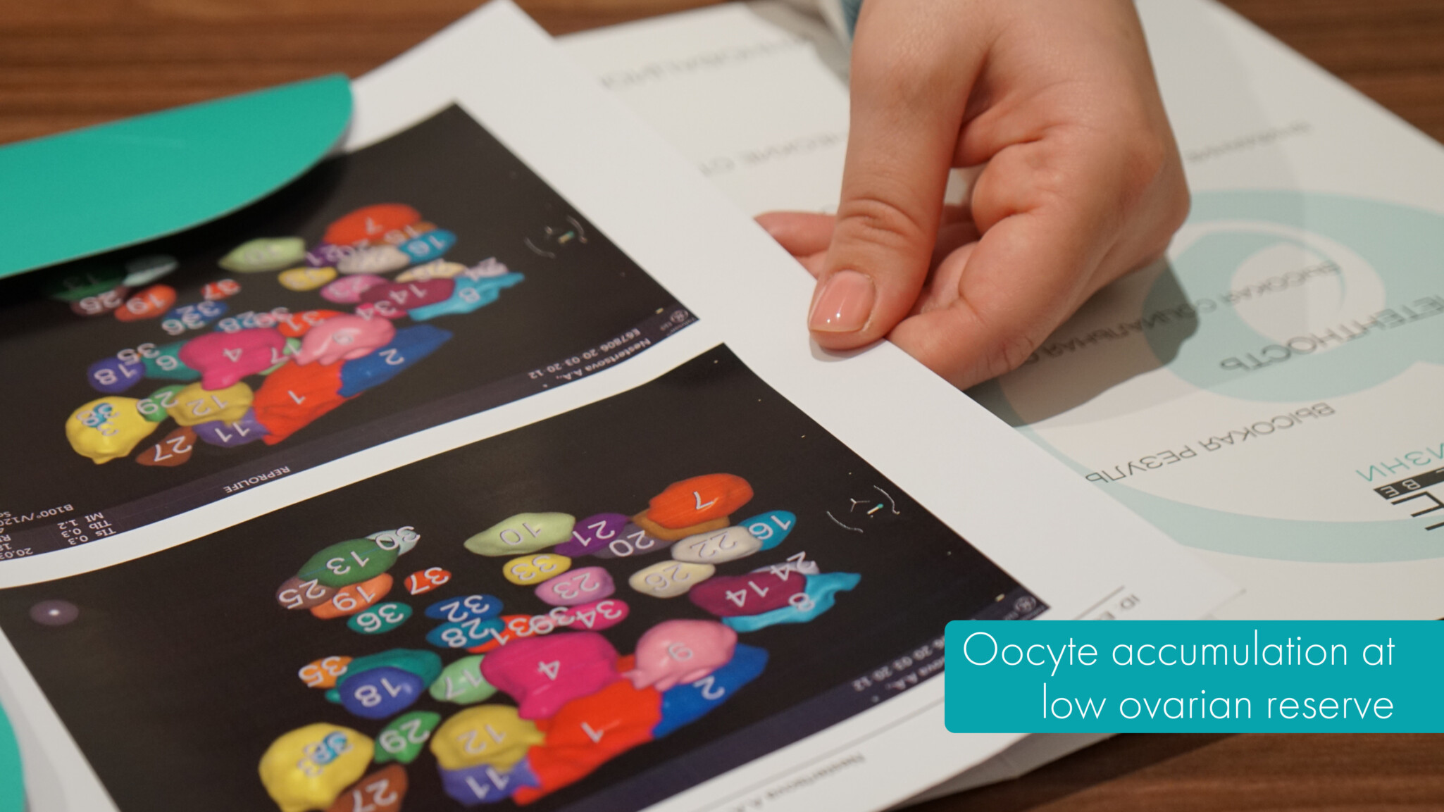 Oocyte accumulation at low ovarian reserve