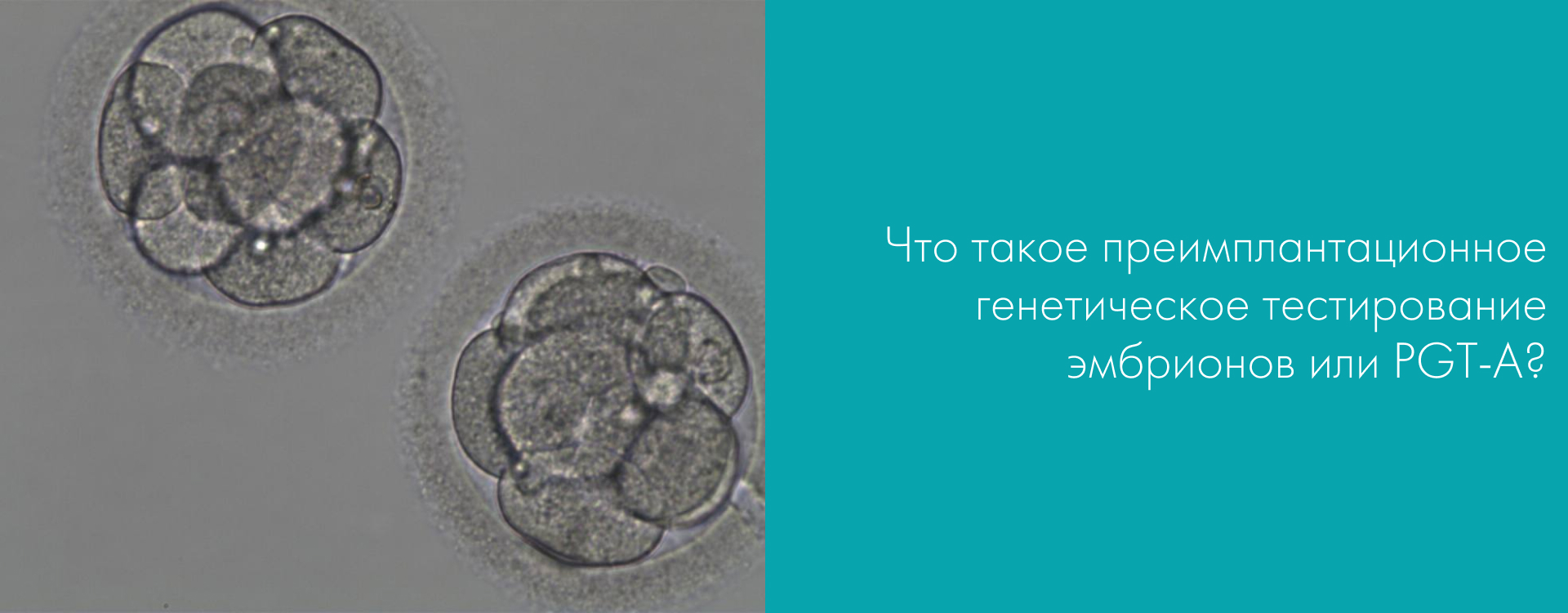 Преимплантационное генетическое тестирование эмбрионов или PGT-A