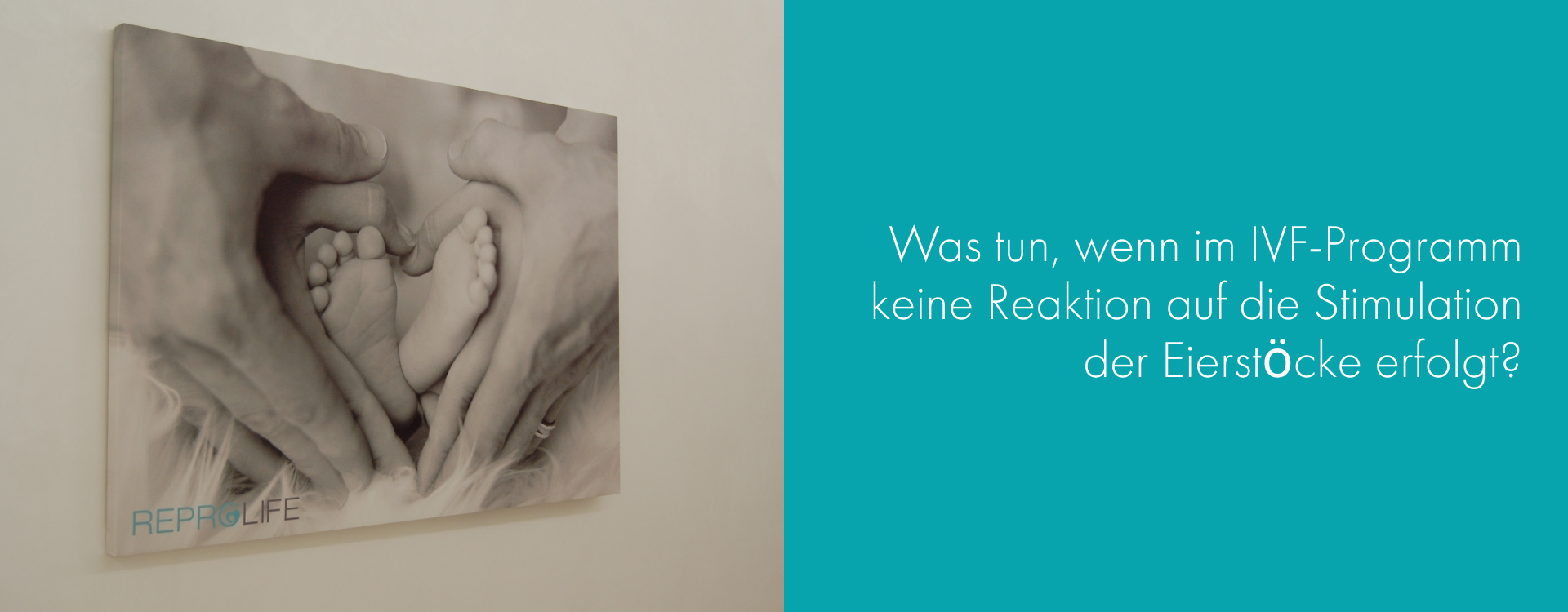 Was können wir tun, wenn im IVF-Programm keine Reaktion auf die Stimulation der Eierstöcke erfolgt?