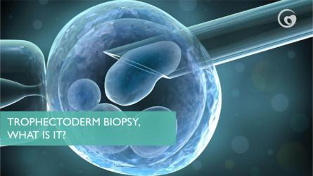Trophectoderm biopsy, what is it?