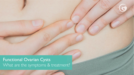 What is a functional ovarian cyst? What the symptoms and treatment?