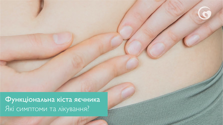 Що таке функціональна кіста яєчника? Які її симптоми та лікування?