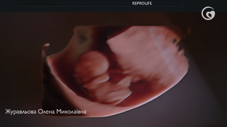 Найбільш поширені питання про рухи малюка під час вагітності