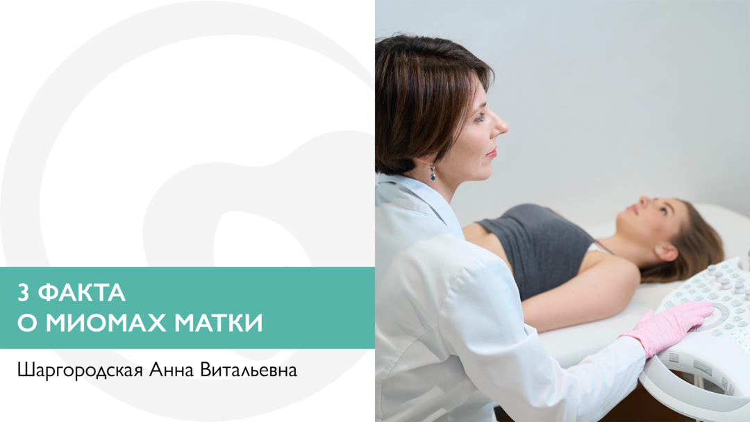 3 факта о миомах матки  