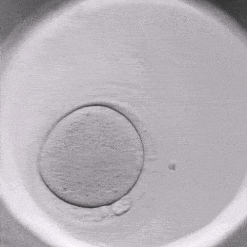 Wie beeinflusst ein Timelapse-Inkubator die Effizienz von IVF-Programmen?