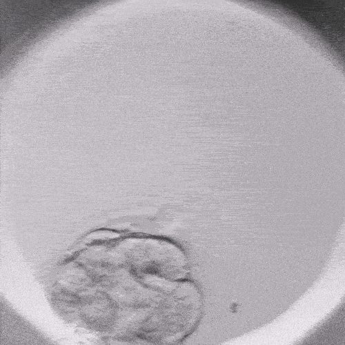 Wie beeinflusst ein Timelapse-Inkubator die Effizienz von IVF-Programmen?