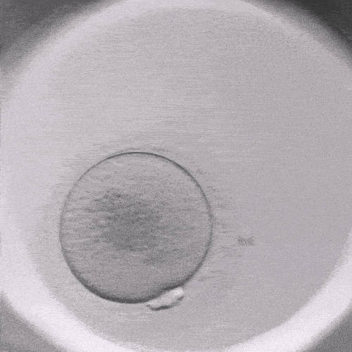 Wie beeinflusst ein Timelapse-Inkubator die Effizienz von IVF-Programmen?