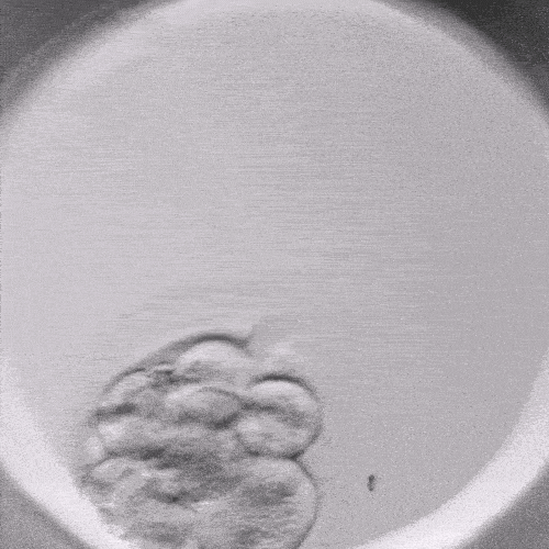 Wie beeinflusst ein Timelapse-Inkubator die Effizienz von IVF-Programmen?