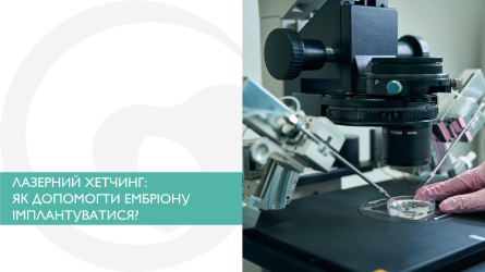Лазерний хетчинг: Як допомогти ембріону імплантуватися?