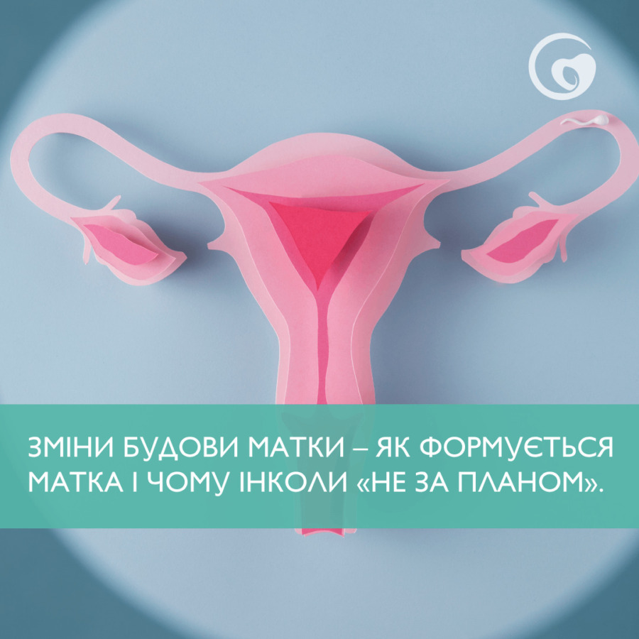 ЗМІНИ БУДОВИ МАТКИ – ЯК ФОРМУЄТЬСЯ МАТКА І ЧОМУ ІНКОЛИ «НЕ ЗА ПЛАНОМ».