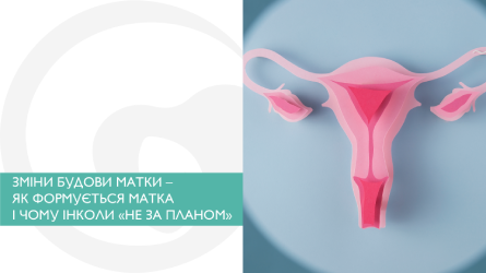 Зміни будови матки – як формується матка і чому інколи «не за планом».