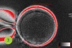 зображення ооцита, отримане за допомогою мікроскопа, оснащеного системою Oosight